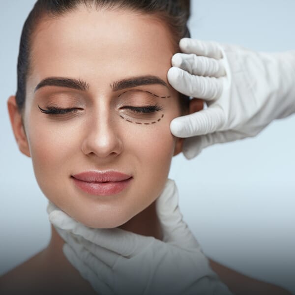 Eyelid Surgery (Blepharoplasty)