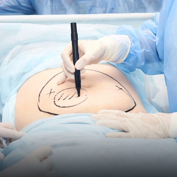 Fat Transfer Surgery: Enhance Your Natural Beauty